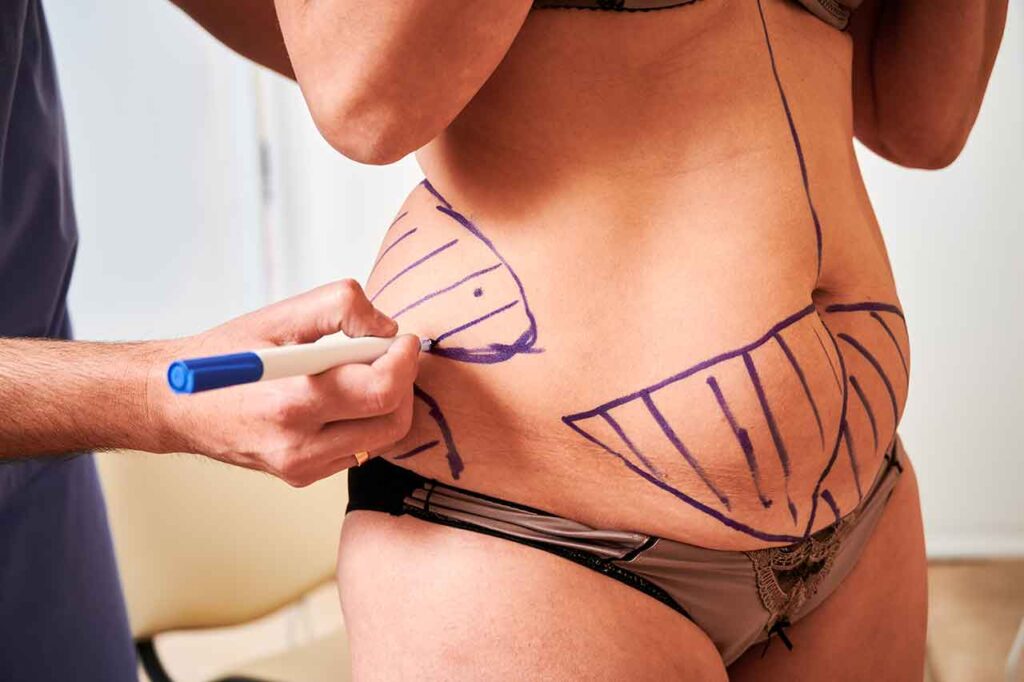 J Plasma agit en provoquant une rétraction immédiate de la peau,