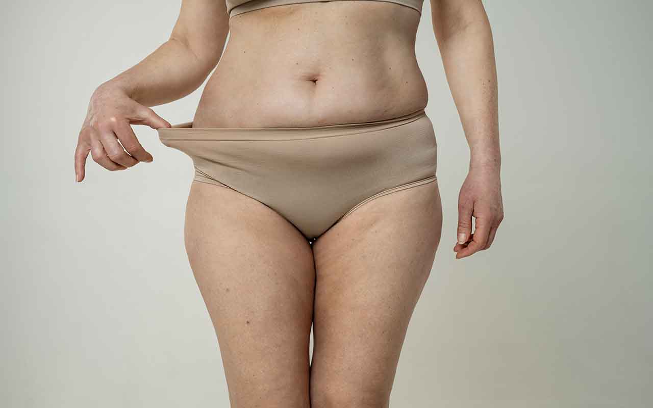 Liposuccion VASER du ventre vs liposuccion classique