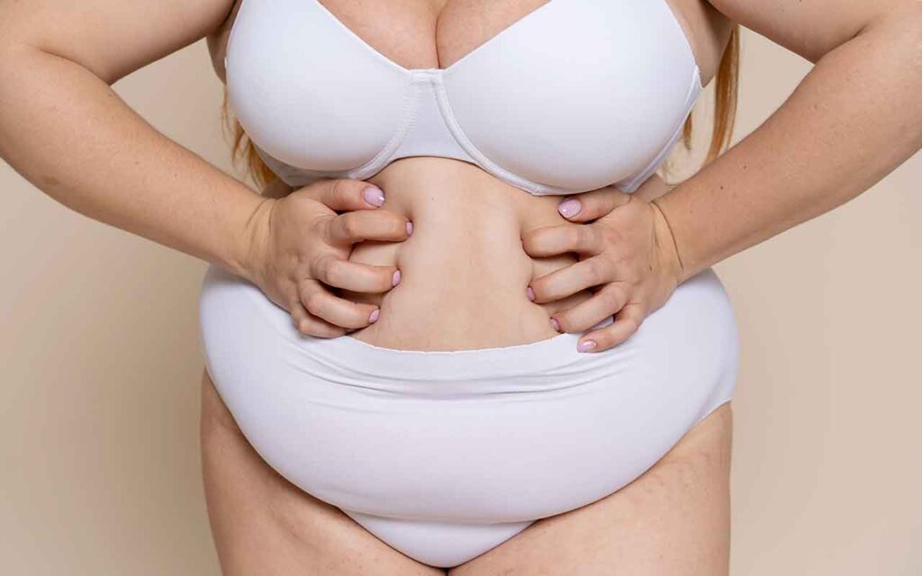 Liposuccion vaser du ventre