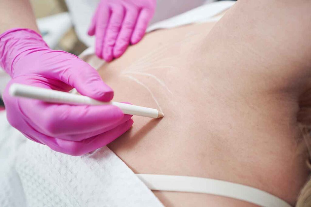 Pourquoi choisir la Tunisie pour un traitement J Plasma ventre ?